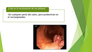 •En cualquier parte del colon, pero predominan en
el rectosigmoides.
¿Cuál es la localización de los pólipos?
 