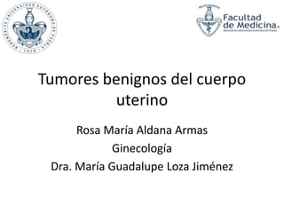 Tumores benignos del cuerpo 
uterino 
Rosa María Aldana Armas 
Ginecología 
Dra. María Guadalupe Loza Jiménez 
 