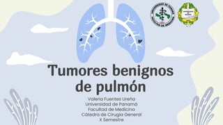 Tumores benignos
de pulmón
Valeria Fuentes Ureña
Universidad de Panamá
Facultad de Medicina
Cátedra de Cirugía General
X Semestre
 
