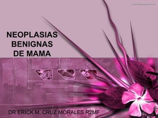 NEOPLASIAS
 BENIGNAS
 DE MAMA




DR ERICK M. CRUZ MORALES R2MF
 