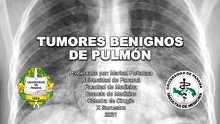 TUMORES BENIGNOS
DE PULMÓN
Presentado por: Maricel Peñaloza
Universidad de Panamá
Facultad de Medicina
Escuela de Medicina
Cátedra de Cirugía
X Semestre
2021
 