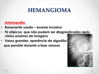 HEMANGIOMA
Arteriografia:
• Raramente usado – exame invasivo
• TU atípicos, que não podem ser diagnosticados após
vários exames de imagens
• Vasos grandes, aparência de algodão
que persiste durante a fase venosa
 