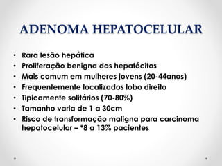 ADENOMA HEPATOCELULAR
• Rara lesão hepática
• Proliferação benigna dos hepatócitos
• Mais comum em mulheres jovens (20-44anos)
• Frequentemente localizados lobo direito
• Tipicamente solitários (70-80%)
• Tamanho varia de 1 a 30cm
• Risco de transformação maligna para carcinoma
hepatocelular – *8 a 13% pacientes
 
