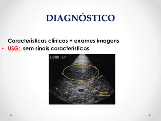 DIAGNÓSTICO
Características clínicas + exames imagens
• USG: sem sinais característicos
 