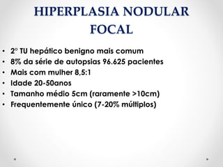 HIPERPLASIA NODULAR
FOCAL
• 2° TU hepático benigno mais comum
• 8% da série de autopsias 96.625 pacientes
• Mais com mulher 8,5:1
• Idade 20-50anos
• Tamanho médio 5cm (raramente >10cm)
• Frequentemente único (7-20% múltiplos)
 
