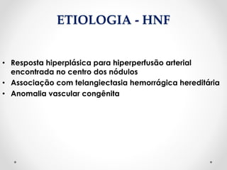 ETIOLOGIA - HNF
• Resposta hiperplásica para hiperperfusão arterial
encontrada no centro dos nódulos
• Associação com telangiectasia hemorrágica hereditária
• Anomalia vascular congênita
 