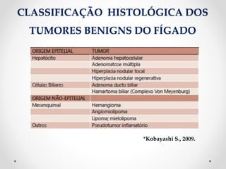 CLASSIFICAÇÃO HISTOLÓGICA DOS
TUMORES BENIGNS DO FÍGADO
*Kobayashi S., 2009.
 
