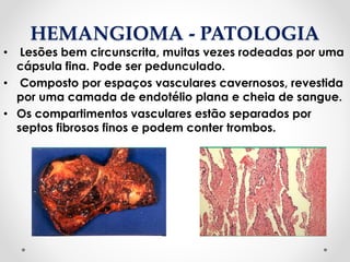 HEMANGIOMA - PATOLOGIA
• Lesões bem circunscrita, muitas vezes rodeadas por uma
cápsula fina. Pode ser pedunculado.
• Composto por espaços vasculares cavernosos, revestida
por uma camada de endotélio plana e cheia de sangue.
• Os compartimentos vasculares estão separados por
septos fibrosos finos e podem conter trombos.
 