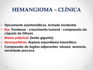 HEMANGIOMA – CLÍNICA
• Tipicamente assintomáticos. Achado incidental.
• Dor: Trombose - crescimento tumoral - compressão da
cápsula de Glisson.
• Massa palpável: (lesão gigante).
• Hemopetitônio: Ruptura espontânea traumática
• Compressão de órgãos adjacentes: náusea, anorexia,
saciedade precoce
 