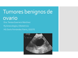 Tumores benignos de
ovario
Dra.Teresa Guerrero Martínez
R3 Ginecología y Obstetricia
HG Darío Fernández Fierro, ISSSTE
 