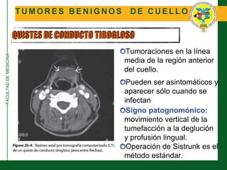 FACULTADDEMEDICINA
T U M O R E S B E N I G N O S D E C U E L L O
QUISTES DE CONDUCTO TIROGLOSO
Tumoraciones en la línea
media de la región anterior
del cuello.
Pueden ser asintomáticos y
aparecer sólo cuando se
infectan
Signo patognomónico:
movimiento vertical de la
tumefacción a la deglución
y profusión lingual.
Operación de Sistrunk es el
método estándar.
 