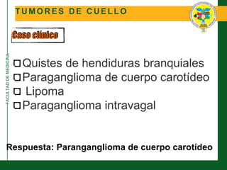 FACULTADDEMEDICINA
T U M O R E S D E C U E L L O
Caso clínico
Quistes de hendiduras branquiales
Paraganglioma de cuerpo carotídeo
Lipoma
Paraganglioma intravagal
Respuesta: Paranganglioma de cuerpo carotídeo
 