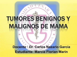 TUMORES BENIGNOS y malignos DE MAMA Docente : Dr. Carlos Nazario García Estudiante: Marcia FlorianMarin 