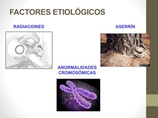 FACTORES ETIOLÓGICOS
ASERRÍNRADIACIONES
ANORMALIDADES
CROMOSÓMICAS
 