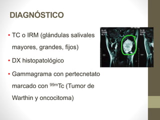 DIAGNÓSTICO
• TC o IRM (glándulas salivales
mayores, grandes, fijos)
• DX histopatológico
• Gammagrama con pertecnetato
marcado con 99mTc (Tumor de
Warthin y oncocitoma)
 