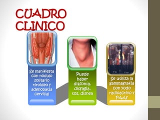 Se manifiesta
con nódulo
solitario
tiroideo y
adenopatía
cervical
A
Title
Se utiliza la
gammagrafía
con yodo
radioactivo y
PAAf
C
Title
Puede
haber
disfonía.
disfagia,
tos, disnea
B
Title
CUADRO
CLINICO
 
