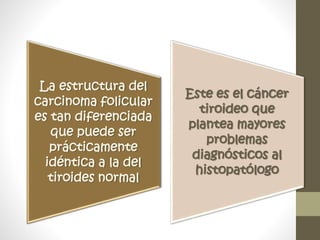 La estructura del
carcinoma folicular
es tan diferenciada
que puede ser
prácticamente
idéntica a la del
tiroides normal
Este es el cáncer
tiroideo que
plantea mayores
problemas
diagnósticos al
histopatólogo
 