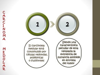 El carcinoma
medular está
constituido por
células redondas,
poliédricas
o fusiformes
Siendo una
característica
peculiar de esta
neoplasia la
existencia de
sustancia amiloide
en estroma
del tumor
1 2
C
A
R
C
I
N
O
M
A
M
E
D
U
L
A
R
 