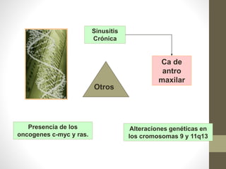 Alteraciones genéticas en
los cromosomas 9 y 11q13
Presencia de los
oncogenes c-myc y ras.
Sinusitis
Crónica
Otros
Ca de
antro
maxilar
 