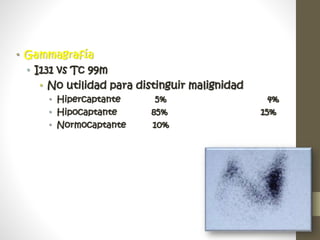 • Gammagrafía
• I131 vs Tc 99m
• No utilidad para distinguir malignidad
• Hipercaptante 5% 4%
• Hipocaptante 85% 15%
• Normocaptante 10%
 