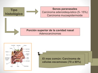 Senos paranasales
Carcinoma adenoidequístico (5- 15%)
Carcinoma mucoepidermoide
Tipo
histológico
Porción superior de la cavidad nasal
Adenocarcinomas
. El mas común: Carcinoma de
células escamosas (70 a 80%)

 