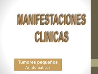 Tumores pequeños
Asintomáticos
 