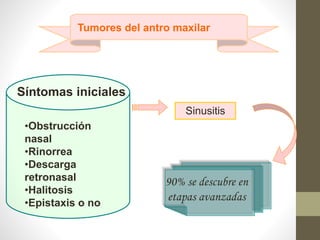 Tumores del antro maxilar
Síntomas iniciales
Sinusitis
•Obstrucción
nasal
•Rinorrea
•Descarga
retronasal
•Halitosis
•Epistaxis o no
90% se descubre en
etapas avanzadas
 