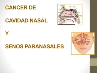 CANCER DE
CAVIDAD NASAL
Y
SENOS PARANASALES
 