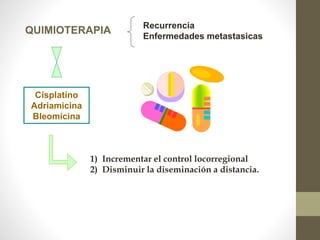 QUIMIOTERAPIA Recurrencia
Enfermedades metastasicas
Cisplatino
Adriamicina
Bleomicina
1) Incrementar el control locorregional
2) Disminuir la diseminación a distancia.
 