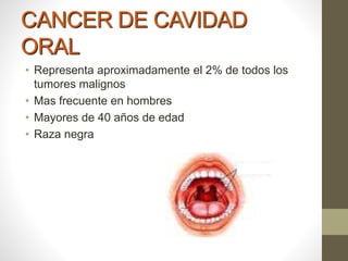CANCER DE CAVIDAD
ORAL
• Representa aproximadamente el 2% de todos los
tumores malignos
• Mas frecuente en hombres
• Mayores de 40 años de edad
• Raza negra
 