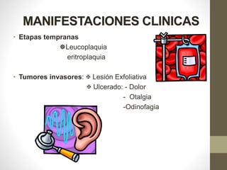 MANIFESTACIONES CLINICAS
• Etapas tempranas
Leucoplaquia
eritroplaquia
• Tumores invasores:  Lesión Exfoliativa
 Ulcerado: - Dolor
- Otalgia
-Odinofagia
 