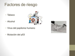 Factores de riesgo
• Tabaco
• Alcohol
• Virus del papiloma humano
• Mutación del p53
 