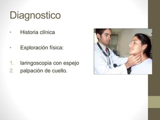 Diagnostico
• Historia clínica
• Exploración física:
1. laringoscopia con espejo
2. palpación de cuello.
 