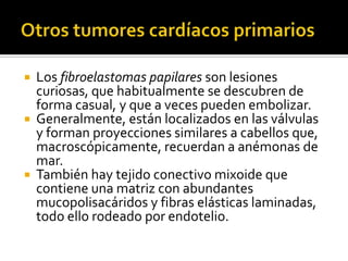 Tumores cardiacos Slide 15