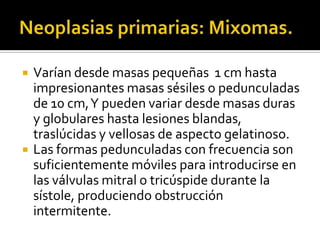 Tumores cardiacos Slide 7