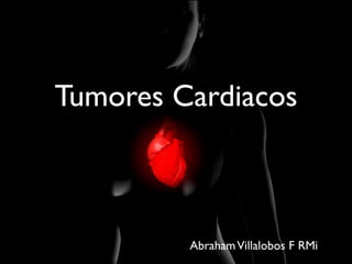 Tumores Cardiacos

Abraham Villalobos F RMi

 