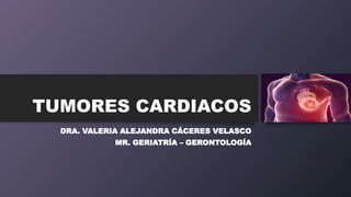 TUMORES CARDIACOS
DRA. VALERIA ALEJANDRA CÁCERES VELASCO
MR. GERIATRÍA – GERONTOLOGÍA
 