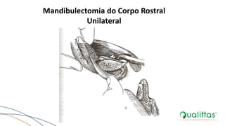 Mandibulectomia do Corpo Rostral
Unilateral
BOJRAB, 1996.
 