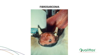 FIBROSARCOMA
 