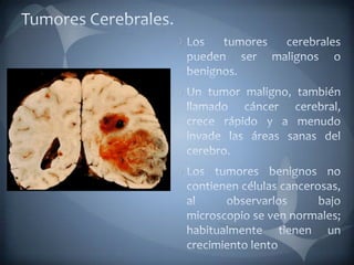 Tumores Cerebrales.Los tumores cerebrales pueden ser malignos o benignos. Un tumor maligno, también llamado cáncer cerebral, crece rápido y a menudo invade las áreas sanas del cerebro. Los tumores benignos no contienen células cancerosas, al observarlos bajo microscopio se ven normales; habitualmente tienen un crecimiento lento