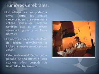 Tumores Cerebrales.La radiación es una poderosa arma contra las células cancerosas, pero a veces mata células sanas del cerebro también; esto es un efecto secundario grave y se llama necrosis. La necrosis puede causar dolor de cabeza, convulsiones o incluso la muerte en unos pocos casos. Esto puede ocurrir dentro de un periodo de seis meses a unos cuantos años después de finalizado el tratamiento. 