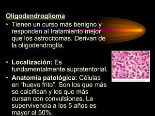 Oligodendroglioma
• Tienen un curso más benigno y
responden al tratamiento mejor
que los astrocitomas. Derivan de
la oligodendroglía.
• Localización: Es
fundamentalmente supratentorial.
• Anatomía patológica: Células
en “huevo frito”. Son los que más
se calcifican y los que más
cursan con convulsiones. La
supervivencia a los 5 años es
mayor al 50%.
 