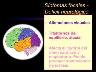 • Alteraciones visuales
• Trastornos del
equilibrio, ataxia.
• Afecta al control del
ritmo cardiaco y
respiratorio. Puede
producir somnolencia
y parálisis.
Síntomas focales -
Déficit neurológico
 