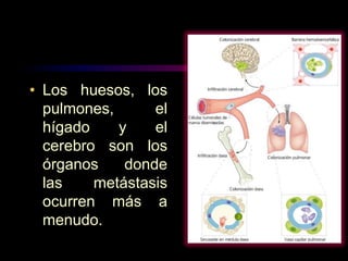• Los huesos, los
pulmones, el
hígado y el
cerebro son los
órganos donde
las metástasis
ocurren más a
menudo.
 