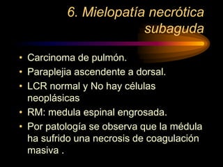 6. Mielopatía necrótica
subaguda
• Carcinoma de pulmón.
• Paraplejia ascendente a dorsal.
• LCR normal y No hay células
neoplásicas
• RM: medula espinal engrosada.
• Por patología se observa que la médula
ha sufrido una necrosis de coagulación
masiva .
 