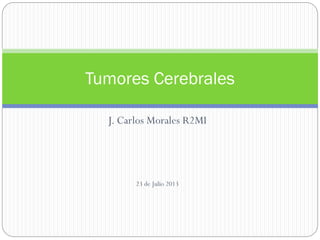 J. Carlos Morales R2MI
23 de Julio 2013
Tumores Cerebrales
 