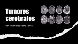 Tumores
cerebrales
R3A José Carlos Molina Porrez
 