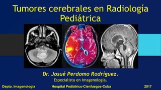 Tumores cerebrales en Radiología
Pediátrica
Dr. Josué Perdomo Rodríguez.
Especialista en Imagenología.
Depto. Imagenología Hospital Pediátrico-Cienfuegos-Cuba 2017
 