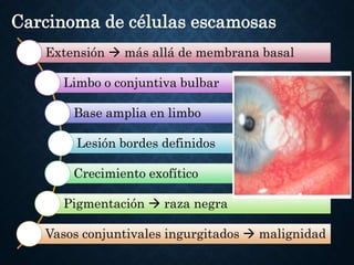 tumores-conjuntivales-benignos-y-malignos-pptx