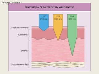 Radiação UltravioletaTumoresCutâneos - 